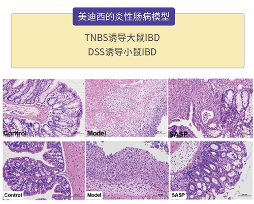 BJL平台的炎症性肠病模子