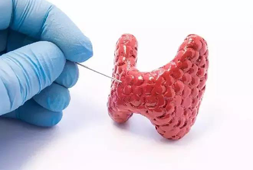 甲状腺疾病，，，，，包括甲状腺功效减退和甲状腺功效亢进，，，，，自古以来就是重复被医学研究职员研究的疾病