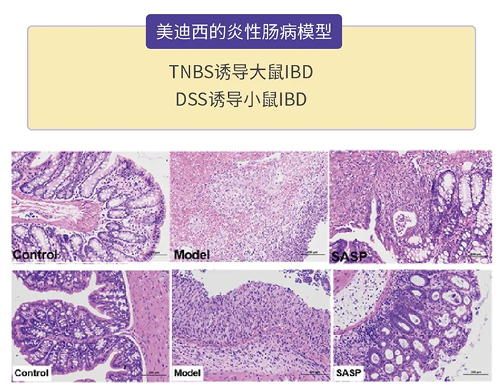BJL平台的炎性肠病模子.png